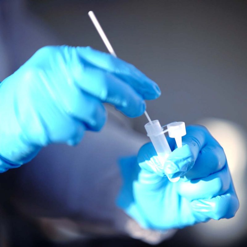 SAFECARE Antigen Schnelltest Kit - Vorratsset – Bild 3